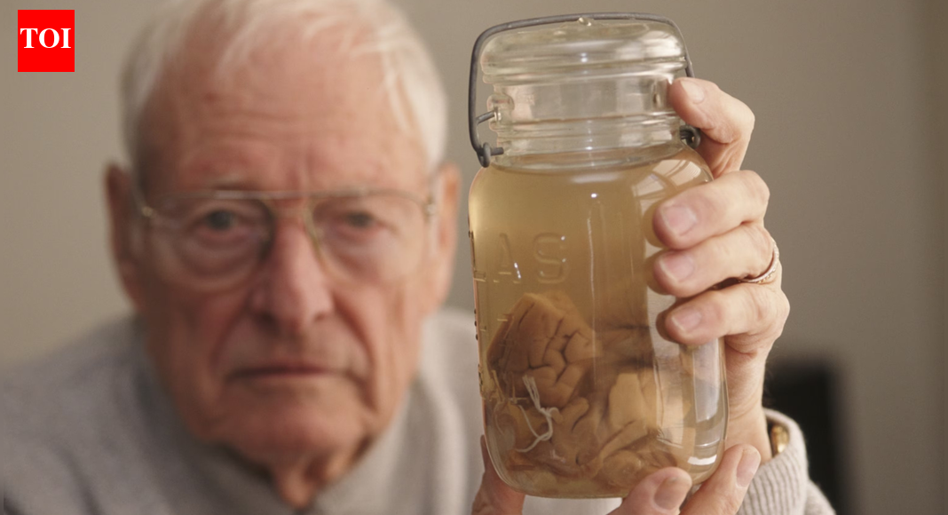 Albert Einstein’s brain was stolen by a doctor and carried around for 40 years |