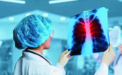 People living near mines showing lung damage | India News