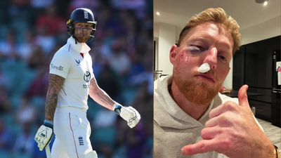 England Test captain Ben Stokes left bloodied after brutal facial injury | Cricket News