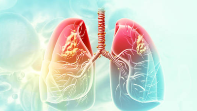 AIIMS-Delhi to study link between lung cancer and air pollution | India News