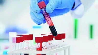Blood test can predict lung cancer 5 years before diagnosis | India News