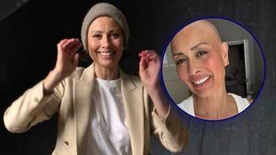 Melanie Sykes reveals her bald look, following the diagnosis of Alopecia: ‘Loss + Gain = Life |