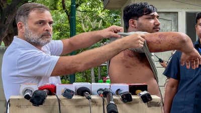 ‘Who approved pellet guns?’ Rahul Gandhi writes Amit Shah over ‘barbaric assault’ on students | India News