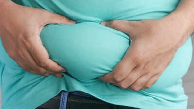 As obesity rises, Supreme Court puts govt on notice over junk food labels | India News