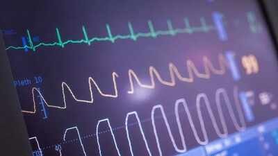 Heart ablation cuts irregular beats, but may not make patients feel better | India News